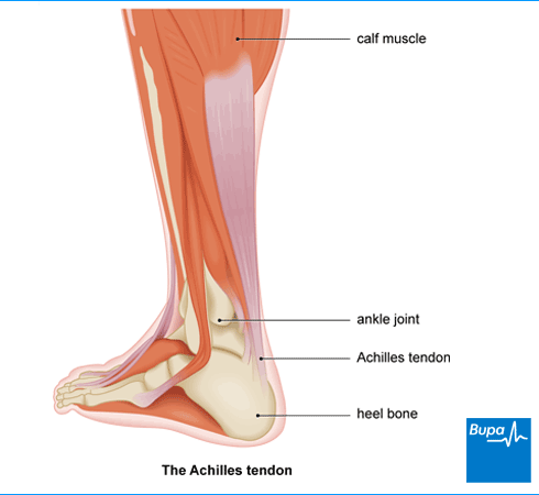strained heel tendon