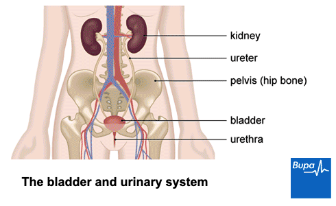 kidney stone pain location